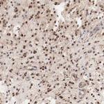 MAGED4 Antibody in Immunohistochemistry (Paraffin) (IHC (P))