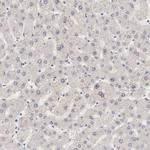 MAGED4 Antibody in Immunohistochemistry (Paraffin) (IHC (P))