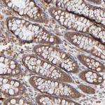 SCFD1 Antibody in Immunohistochemistry (Paraffin) (IHC (P))