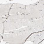 SCFD1 Antibody in Immunohistochemistry (Paraffin) (IHC (P))