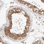 SCFD1 Antibody in Immunohistochemistry (Paraffin) (IHC (P))