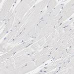 GPR143 Antibody in Immunohistochemistry (IHC)