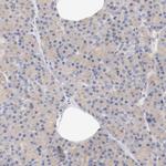 DYNC1H1 Antibody in Immunohistochemistry (IHC)