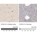 DYNC1H1 Antibody