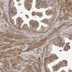 PAXBP1 Antibody in Immunohistochemistry (Paraffin) (IHC (P))