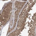 PAXBP1 Antibody in Immunohistochemistry (Paraffin) (IHC (P))