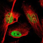 FOXP1 Antibody in Immunocytochemistry (ICC/IF)