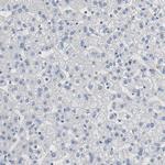 FOXP1 Antibody in Immunohistochemistry (Paraffin) (IHC (P))