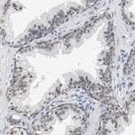 FOXP1 Antibody in Immunohistochemistry (Paraffin) (IHC (P))