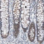 FOXP1 Antibody in Immunohistochemistry (Paraffin) (IHC (P))