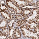 NDUFS4 Antibody in Immunohistochemistry (Paraffin) (IHC (P))