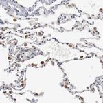 NDUFS4 Antibody in Immunohistochemistry (Paraffin) (IHC (P))