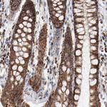 NDUFS4 Antibody in Immunohistochemistry (Paraffin) (IHC (P))