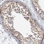 NDUFS4 Antibody in Immunohistochemistry (Paraffin) (IHC (P))