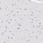 LAX1 Antibody in Immunohistochemistry (IHC)