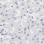 LAX1 Antibody in Immunohistochemistry (IHC)