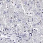 ADAR Antibody in Immunohistochemistry (IHC)