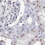 ADAR Antibody in Immunohistochemistry (IHC)