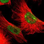 ADAR Antibody in Immunocytochemistry (ICC/IF)