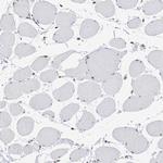 ADAR Antibody in Immunohistochemistry (Paraffin) (IHC (P))