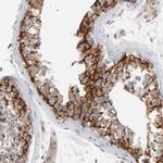 ITPR3 Antibody in Immunohistochemistry (Paraffin) (IHC (P))