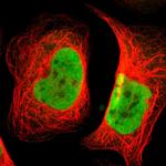 BAF57 Antibody in Immunocytochemistry (ICC/IF)