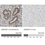 BAF57 Antibody in Immunohistochemistry (IHC)