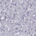 PCSK1N Antibody in Immunohistochemistry (IHC)