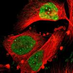 NFIB Antibody in Immunocytochemistry (ICC/IF)