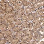 PKN1 Antibody in Immunohistochemistry (Paraffin) (IHC (P))