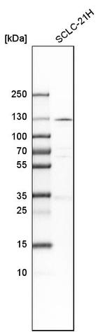 PKN1 Antibody in Western Blot (WB)