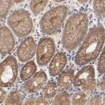 RAB13 Antibody in Immunohistochemistry (Paraffin) (IHC (P))