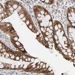 ZNF222 Antibody in Immunohistochemistry (Paraffin) (IHC (P))