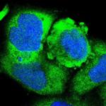 RARS Antibody in Immunocytochemistry (ICC/IF)