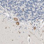 RARS Antibody in Immunohistochemistry (Paraffin) (IHC (P))