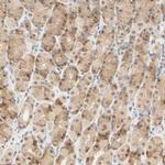 ACSS2 Antibody in Immunohistochemistry (IHC)