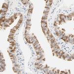 ACSS2 Antibody in Immunohistochemistry (IHC)