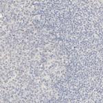 ACSS2 Antibody in Immunohistochemistry (IHC)