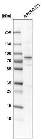 ACSS2 Antibody in Western Blot (WB)