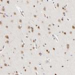 NOVA1 Antibody in Immunohistochemistry (Paraffin) (IHC (P))