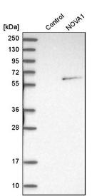 NOVA1 Antibody in Western Blot (WB)