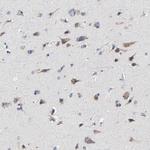 Calpain 10 Antibody in Immunohistochemistry (Paraffin) (IHC (P))