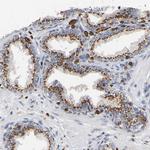 Calpain 10 Antibody in Immunohistochemistry (Paraffin) (IHC (P))