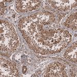 ZNF473 Antibody in Immunohistochemistry (Paraffin) (IHC (P))