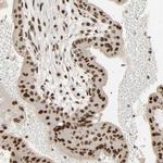 NCOA6 Antibody in Immunohistochemistry (IHC)