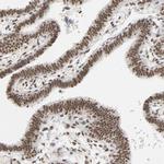 NCOA6 Antibody in Immunohistochemistry (IHC)