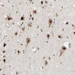 DAZAP1 Antibody in Immunohistochemistry (Paraffin) (IHC (P))