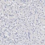 FGFBP1 Antibody in Immunohistochemistry (Paraffin) (IHC (P))