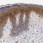 FGFBP1 Antibody in Immunohistochemistry (Paraffin) (IHC (P))