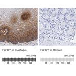 FGFBP1 Antibody in Immunohistochemistry (IHC)